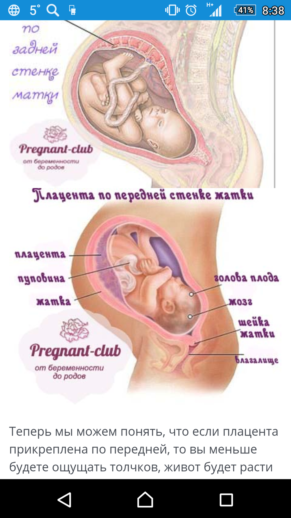 Плацентация по передней стенке после кесарева