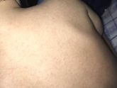 Подскажите это потница или аллергия