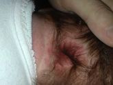 SOS! Аллергия?шелушения кожи?