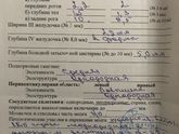Узи головного мозга.