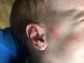 Лактазная недостаточность или что?