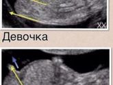 Первый скрининг