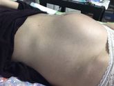 Кто принимал утрожестан от