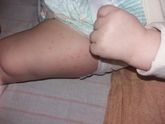 Только вылечились от одного