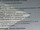 Вот узи