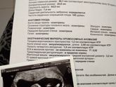Первый скрининг: УЗИ! (02.09.2017)
