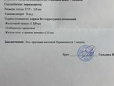 УЗИ