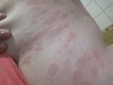 Сыпь! Может подскажет кто?