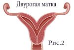 ДМ