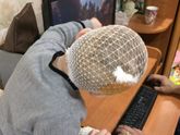 Сынок рассек себе голову