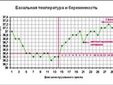 БТ