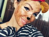 Трескаются губы ? (