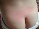 Может быть реакция такая