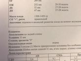 УЗИ, 29 недель