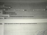 УЗИ Предстательной железы