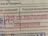 ПЦР