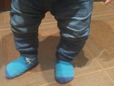 Кривые ножки
