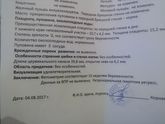 Сходила на Узи, сказали