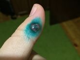 Капилляр