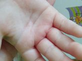 Покраснела ручка