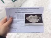 Девчонкой нормальный ли прирост?14