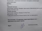Овуляция