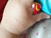 Чем лечить такие прыщи и что это???