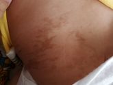 В роддоме при рождении не было пятен