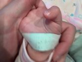Мозоли