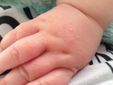Помогите понять что с руками ребёнка!
