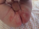 Девочки, может цинковой пастой