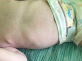 От чего могло возникнуть
