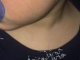 Аллергия или что то другое?