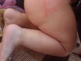 Девочки, помогите разобраться с непонятной сыпью