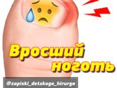 Записки детского хирурга