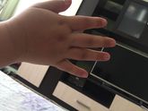 Отеки