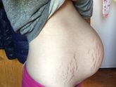 Вторые роды. ( для тех кого стимулировали в первый раз)
