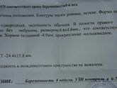 Девочки сегодня узи зделала