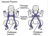 Прододжение. Дисплазия тазобедренного сустава наша история.
