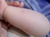 Чем можно помазать место