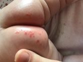 Не проходит попка