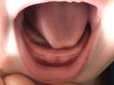 Зубы