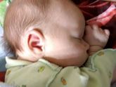Педиатр тоже не понял желтая кожа или нет