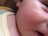 Аллергия или нет??