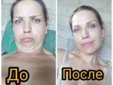 Похудение