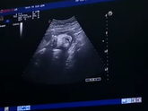 🌹33 неделя 🌹беременности 🤰