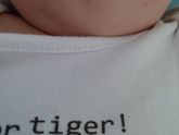 Сыпь, что это?