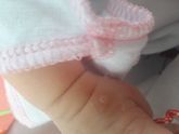 Мамочки подскажите пожалуйста что это может быть? Нам всего лишь 6 дней.