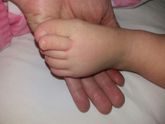 Неровные пальчики на ножках