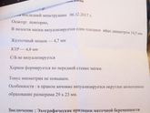 ЗБ.Полная история. Может,кому сгодится.